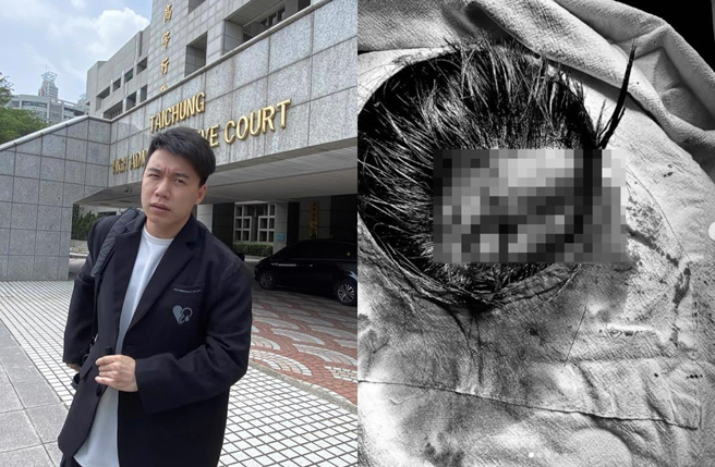 网红Toyz惨遭网红超哥暴打。（图／中时资料照）