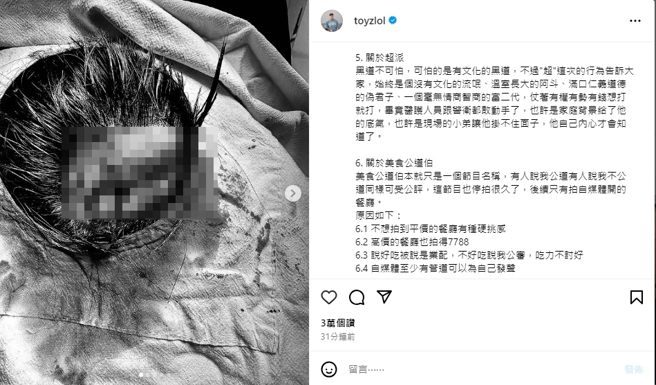 Toyz被暴打后隔2日首更新社群，发布伤势照。（图／Toyz Instagram）
