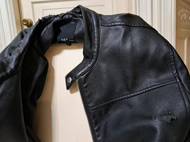 男子分享自己的NET皮衣脱皮情形。（翻摄自爆料公社二社脸书）