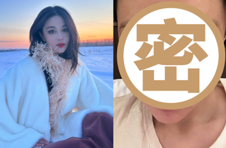 最美軍嫂零下40度拍戲 臉爛原因曝1物「低溫燙傷 」