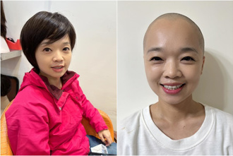 41歲水上鄉長林緗亭罹患乳癌 正向曬「光頭照」展現招牌笑容