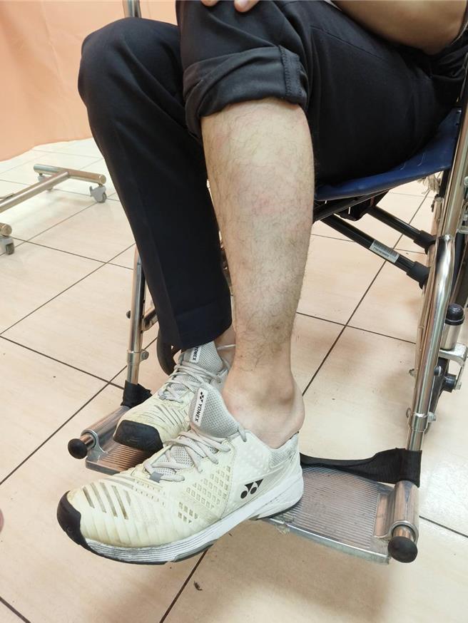 民进党嘉义市议员林炜轩疑行车纠纷当街被痛殴，腿受伤。（廖素慧摄）