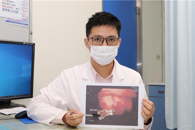 仁爱长庚合作联盟医院胃肠肝胆科医师林彦廷指出，慢性贫血虽非罕见疾病，但造成慢性贫血的原因千变万化，可能与体内器官功能下降或其他疾病有关，建议及早寻求医疗专业帮助。（大里仁爱医院提供／潘虹恩台中传真）