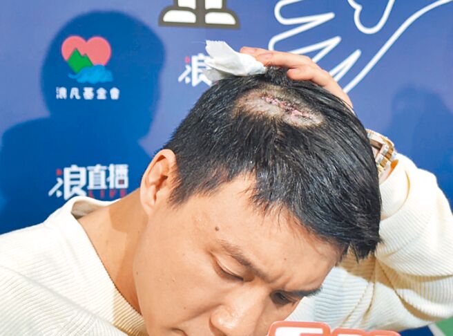 Toyz日前遭超哥痛殴，头部缝了11针。（谢佩桦摄）