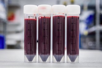 自體治療新突破 利用骨髓細胞修補受損的膀胱