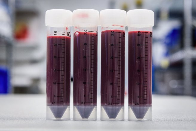  骨髓有相當多的幹細胞，不只可以治療白血病，也能修補其他組織，包括必須持續增長的膀胱。(圖/shutterstock/達志影像)