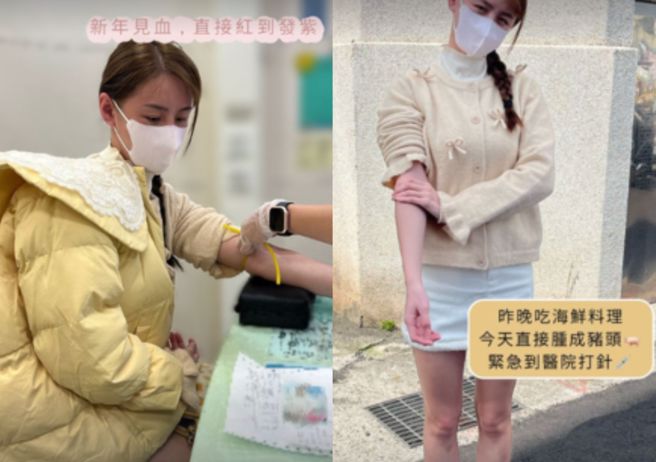 短今12日在Instagram上传就医照。（图／短今 IG）