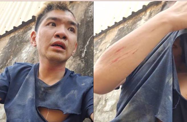 晚安小鸡直播曝伤痕。（图／取自晚安小鸡脸书）