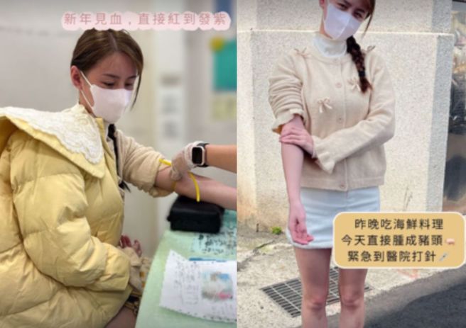 短今12日上傳就醫照。（圖／翻攝自短今 IG）