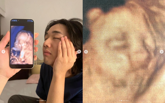 李权哲晒出梁凯莉的超音波照。（图／摘自李权哲Instagram）