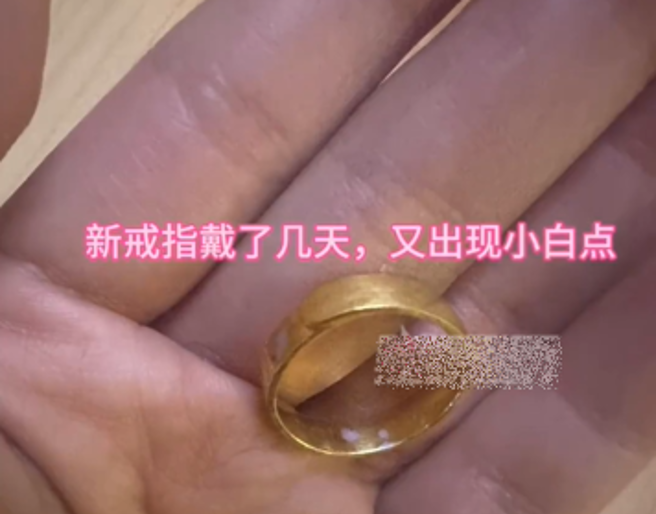大陸有女子戴戒指，戴沒多久發現有「小白點」褪色跡象，竟然是救命警示。（圖／翻攝自微博）
