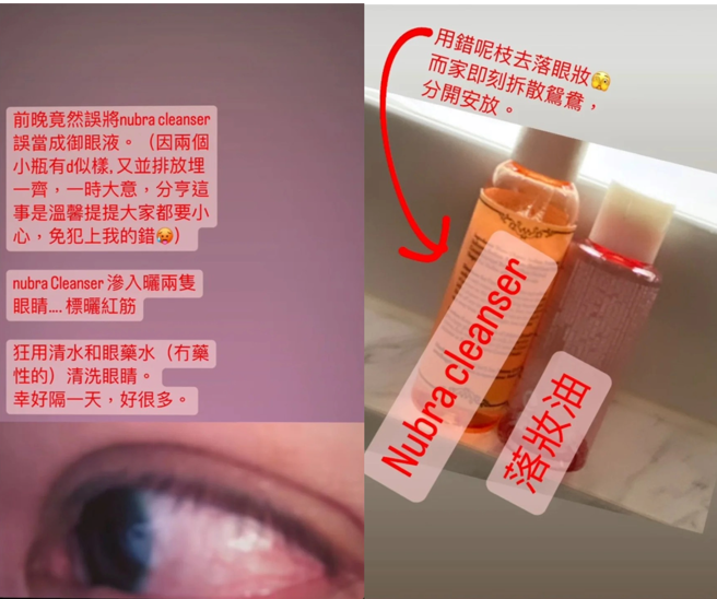 郑秀文误用清洁剂卸妆。(图／郑秀文 IG)