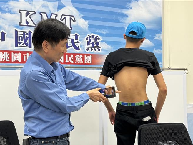 詹江村爆未成年遭警方打到全身伤。(蔡依珍摄)