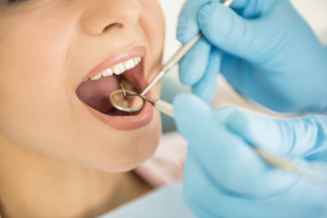 網友好奇為何檢查牙齒前，醫師都會先幫忙洗牙，真相驚呆眾人。（圖：shutterstock／達志）