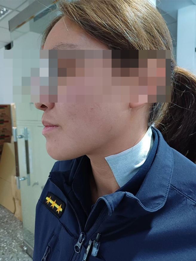 張姓女警頭部及頸部挫傷。（淡水警分局提供／張鎧乙新北傳真）