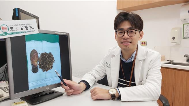 2024年2月29日新北市／醫師吳東琰說明，最常見為右上腹痛（膽絞痛），常併發急、慢性膽囊炎，嚴重可能造成膽道阻塞、胰臟炎甚至進展為膽囊癌。（新北市三峽恩主公醫院提供／劉瑋晴新北傳真）