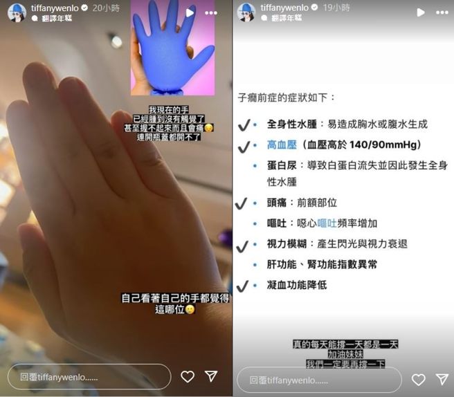 毛加恩孕妻Tiffany透露因「子癫前症」手部有严重水肿。(图／tiffanywenlo IG)