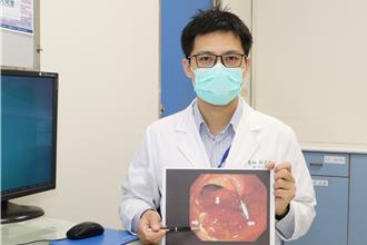 檢出大腸癌莫慌！ 男子就醫揪出良性腺瘤 醫師籲注意「這些症狀」