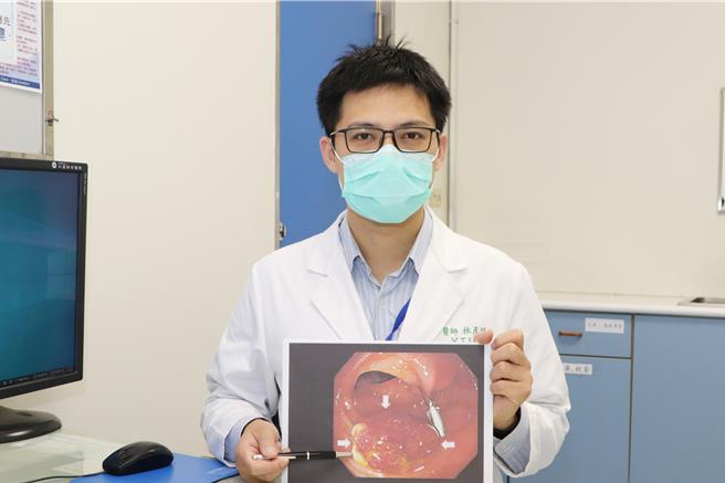 仁爱长庚合作联盟医院胃肠肝胆科医师林彦廷4日提醒，粪便潜血检查安全且方便，但准确度非百分之百，提醒民眾若验出阳性可尽速就医检查、确认。（大里仁爱医院提供／潘虹恩台中传真）