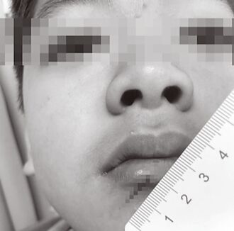 台東 捉寶衝突劃傷同學 校令禁帶刀具