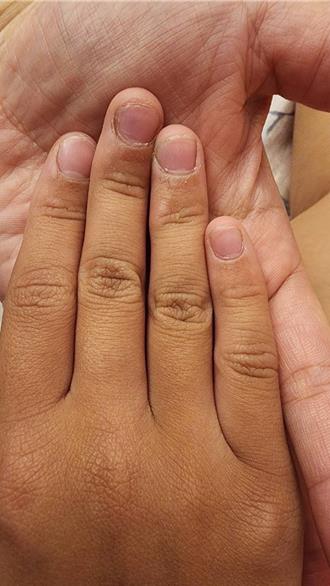 高雄小學教師疑體罰學生 數10名家長連署教育局停職調查