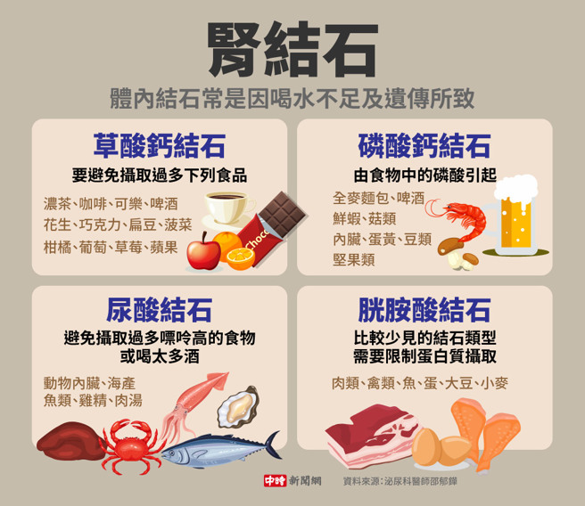肾结石(制图/中时新闻网)