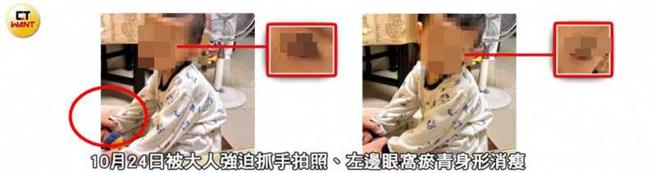 去年10月，剀剀疑似被大人强迫抓手拍照（红圈处），且左边眼窝瘀青、身形消瘦。（图／当事人提供／本刊绘图组）