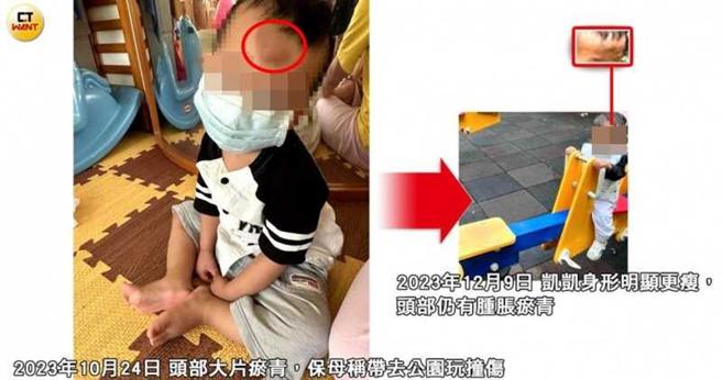去年10月24日，保母称剀剀头部大片瘀青为公园玩耍不慎撞到，但是隔2个月，其头部却仍有明显肿块。（图／当事人提供／本刊绘图组）