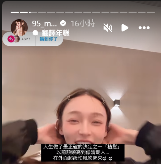 林襄坦承自己有植髮。（圖／擷取自林襄IG）