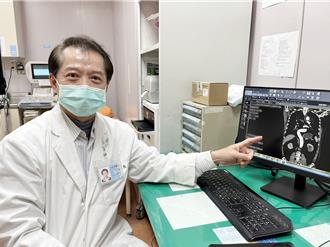 打喷嚏竟害大动脉一路爆裂40cm 急诊医曝「要命」关键