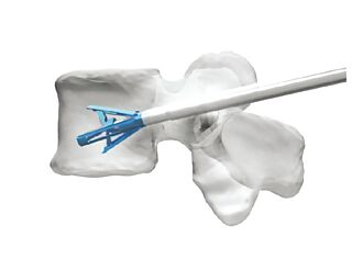 台微医跃进国际 创新医材广销海外