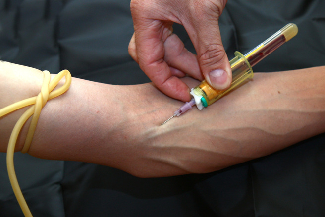 19歲男家中猝死！父整理遺物驚見8個月內賣血16次，嚴重貧血身亡。(圖:Shutterstock/達志）