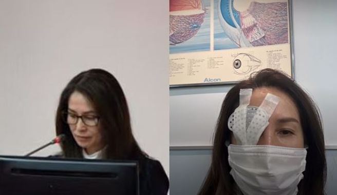 左為高金素梅今早質詢畫面、右為開刀後照片。（取自國會頻道、高金素梅臉書）