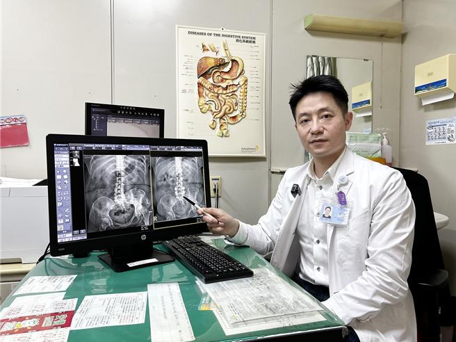 澄清医院中港院区脊椎外科医师锺玉轩指出，经影像检查发现，59岁的廖小姐髋关节变形，第4、5腰椎严重侧弯且压迫神经产生坐骨神经痛。（澄清医院提供／冯惠宜台中传真）