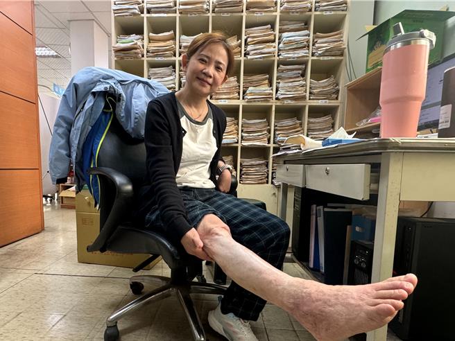 李綜合醫療社團法人護理師陳淑惠右腳有400根釘子，仍跟著白沙屯媽祖遶境。（李綜合醫院提供／李京昇苗栗傳真）