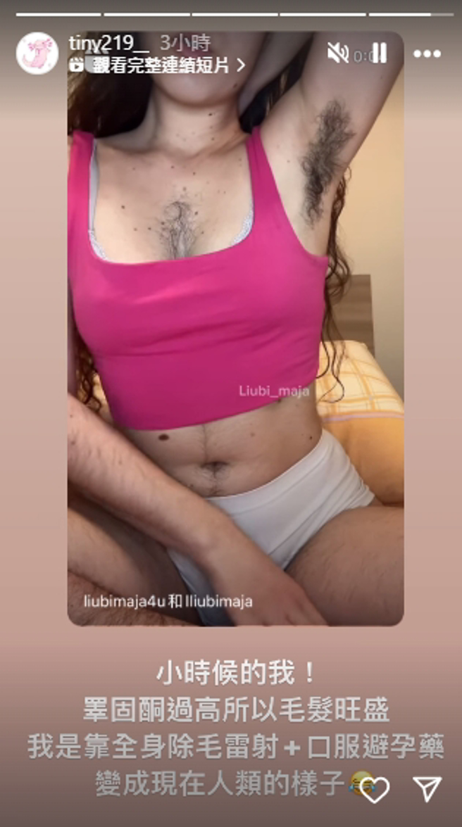 网红胎尼自曝从小就毛髮旺盛。（图／tiny219__ IG）