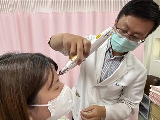 中醫雷射針灸治療乾眼症 59歲婦追劇不再畏光