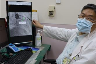 白沙屯媽祖香燈腳「背劇痛」送醫 突發心肌梗塞手術搶命 