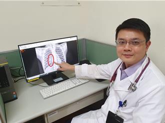 3岁童发烧连咳3天进加护 验出「人类间质肺炎」病毒