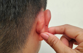 身上4部位有「吉痣」 好运跟着来！长在耳后一生财运旺