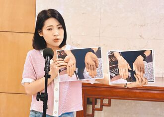 廚師手有米酵菌酸 住家採檢連假後出爐