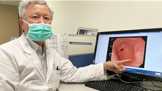 47歲護理師超養生 胃悶痛半年竟罹「最凶險胃癌」 