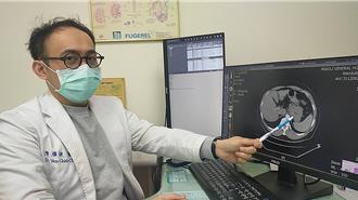 男長期腹痛、噁心驚見胃間質瘤 醫曝：難早期發現