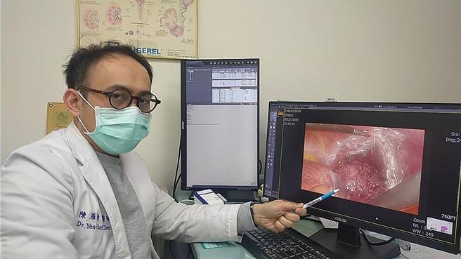 陳雁捷醫師指出，利用全腹腔鏡手術切除巨大胃間質瘤。（部苗醫院提供／李京昇苗栗傳真）