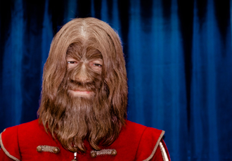 儿子出生像「狼人」 产妇自责：怀孕吃猫被诅咒