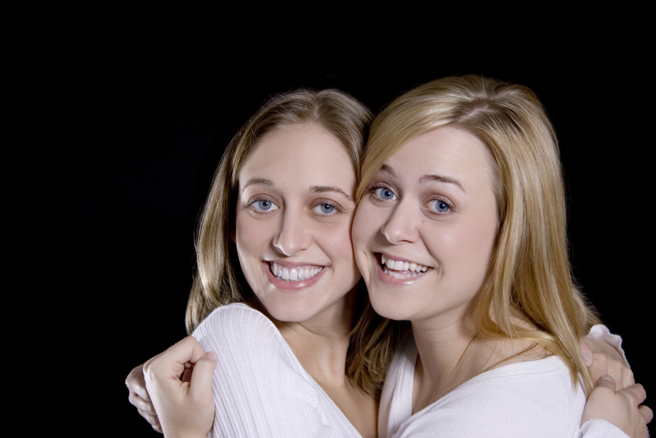 世上最年長連體雙胞蘿莉和喬治在4月7日過世，頭部相連長達62年，雖然身體連在一起，但各自生活都很精采。（示意圖：Shutterstock／達志）