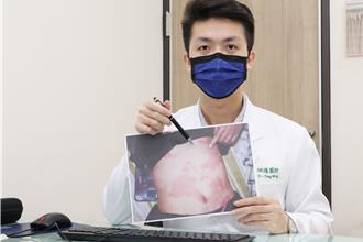 高烧红疹5天不退！女全身现皮疹紫斑 就医病因曝光