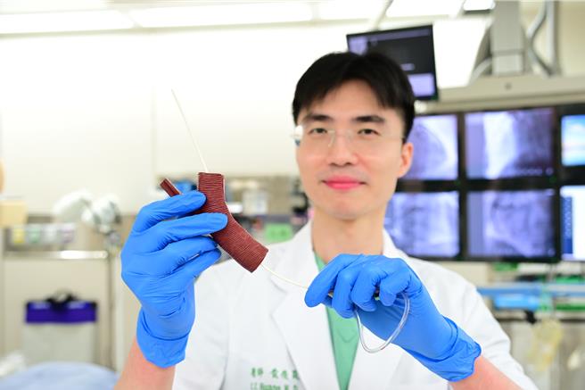 亚洲大学附属医院心臟外科医师黄俊晟指出，透过导管将回流静脉「封路」，改善静脉曲张问题。（亚大医院提供／冯惠宜台中传真）