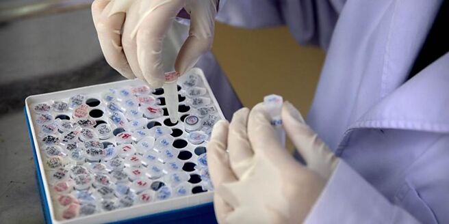 共信肺癌新药PTS302已打进中国50家医院、四项产品陆续进入二／三期临床，2025年拚转盈。图／美联社