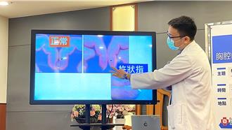 「菜瓜布肺」致命性高 醫曝好發的年齡與族群